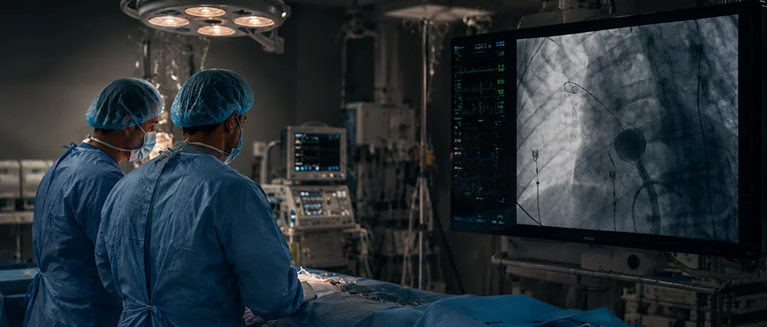 Lebanon pioneers revolutionary atrial fibrillation treatment